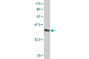 Western Blot detection against Immunogen (37. (SUMO3 anticorps  (AA 1-103))