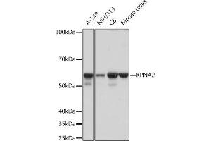 Western blot analysis of extracts of various cell lines, using KPN Rabbit mAb (ABIN1680520, ABIN3019328, ABIN3019329 and ABIN7101751) at 1:1000 dilution. (KPNA2 anticorps)