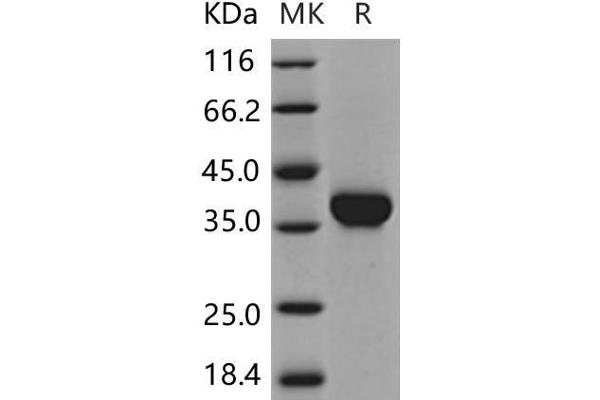 CA10 Protein (His tag)