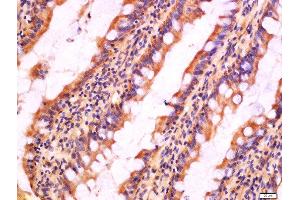 Immunohistochemistry (Paraffin-embedded Sections) (IHC (p)) image for anti-NLR Family, Pyrin Domain Containing 3 (NLRP3) (AA 15-120) antibody (ABIN1386361)