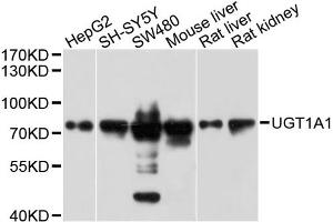 Western blot analysis of extracts of various cell lines, using UGT1A1 antibody (ABIN1875274) at 1:1000 dilution. (UGT1A1 anticorps)