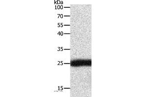 Western blot analysis of Hela cell, using SNAP25 Polyclonal Antibody at dilution of 1:400 (SNAP25 anticorps)
