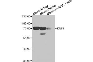 Western blot analysis of extracts of various cell lines, using KRT5 antibody (ABIN5971441) at 1/500 dilution. (Cytokeratin 5 anticorps)