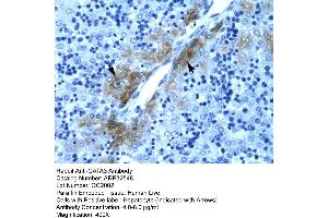 Rabbit Anti-GATA3 Antibody  Paraffin Embedded Tissue: Human Liver Cellular Data: Hepatocyte Antibody Concentration: 4. (GATA3 anticorps  (C-Term))