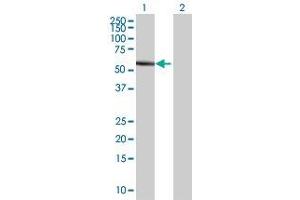 Lane 1: PSMD5 transfected lysate ( 55. (PSMD5 293T Cell Transient Overexpression Lysate(Denatured))