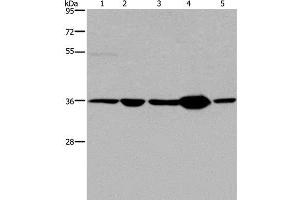 Western Blot analysis of Human transitional cell carcinoma tissue, 293T and A172 cell, Human testis tissue and Hela cell using LZTFL1 Polyclonal Antibody at dilution of 1:550 (LZTFL1 anticorps)