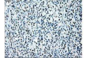 Image no. 1 for anti-B-Raf proto-oncogene, serine/threonine kinase (BRAF) antibody (ABIN1496959) (BRAF anticorps)