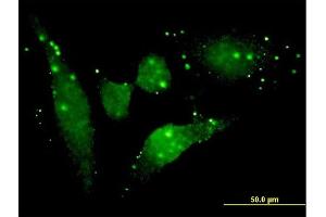 Immunofluorescence of monoclonal antibody to FGFR2 on HeLa cell. (FGFR2 anticorps  (AA 621-723))