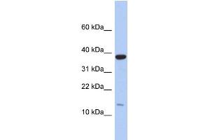 WB Suggested Anti-RPL27 Antibody Titration: 0. (RPL27 anticorps  (Middle Region))