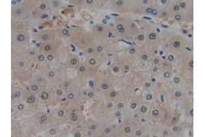 DAB staining on IHC-P; Samples: Human Liver Tissue (MT-ND1 anticorps  (AA 186-270))