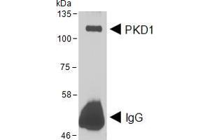 Western Blotting (WB) image for anti-Protein Kinase D1 (PRKD1) (AA 233-246) antibody (ABIN5874190) (PKC mu anticorps  (AA 233-246))