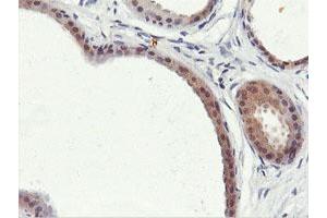 Immunohistochemical staining of paraffin-embedded Human breast tissue using anti-PNPO mouse monoclonal antibody. (PNPO anticorps)