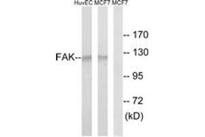 Western Blotting (WB) image for anti-PTK2 Protein tyrosine Kinase 2 (PTK2) (AA 809-858) antibody (ABIN2889088) (FAK anticorps  (AA 809-858))