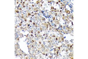 Immunohistochemistry of paraffin-embedded human appendix using KIFC1 Rabbit mAb (ABIN1680485, ABIN3015039, ABIN3015040 and ABIN7101305) at dilution of 1:100 (40x lens). (KIFC1 anticorps)