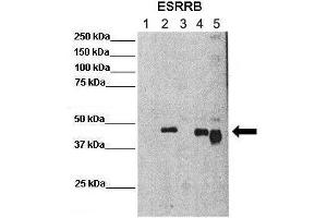 Lanes :  Lane 1: 25ug mouse ES cellsLane 2: 25ug mouse ES cells overexpressing FLAG EsrrB (mouse)Lane 3: 25ug chromatin fraction CV1 cellsLane 4: 25ug chromatin fraction CV1 cells overexpressing FLAG EsrrB (mouse)Lane 5: 25ug chromatin fraction CV1 cells overexpressing FLAG EsrrB-Deltacter (mouse)   Primary Antibody Dilution :   1:500    Secondary Antibody :  Anti-rabbit-HRP   Secondary Antibody Dilution :   1:3000   Gene Name :  ESRRB   Submitted by :  Domenico Maiorano, Institute of Human Genetics (IGH) (ESRRB anticorps  (N-Term))