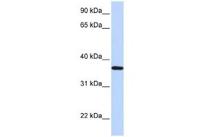 WB Suggested Anti-LCN12 Antibody Titration: 0. (LCN12 anticorps  (N-Term))