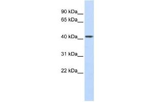 Western Blotting (WB) image for anti-Carboxypeptidase B2 (Plasma) (CPB2) antibody (ABIN2458761) (CPB2 anticorps)