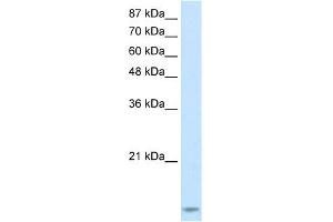 WB Suggested Anti-TARBP2 Antibody Titration:  2. (TARBP2 anticorps  (N-Term))