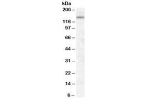 Western blot testing of KELLY cell lysate with DLG1 antibody at 0. (DLG1 anticorps)