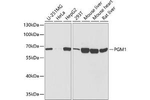 Western blot analysis of extracts of various cell lines, using PGM1 antibody  at 1:1000 dilution. (Phosphoglucomutase 1 anticorps  (AA 1-300))