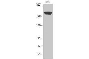 Western Blotting (WB) image for anti-Insulin Receptor Substrate 1 (IRS1) (Ser62) antibody (ABIN3185240) (IRS1 anticorps  (Ser62))