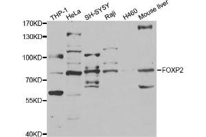 Western blot analysis of extracts of various cell lines, using FOXP2 antibody (ABIN5973317) at 1/1000 dilution. (FOXP2 anticorps)
