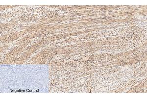 Immunohistochemical analysis of paraffin-embedded human uterus tissue. (CREB1 anticorps  (pSer133))