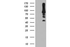 HEK293T cells were transfected with the pCMV6-ENTRY control (Left lane) or pCMV6-ENTRY PFKP (Right lane) cDNA for 48 hrs and lysed. (PFKP anticorps)