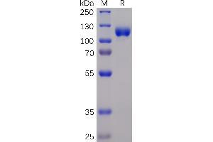 Human E Protein, mFc-His Tag on SDS-PAGE under reducing condition. (EPH Receptor A3 Protein (EPHA3) (AA 21-541) (mFc-His Tag))