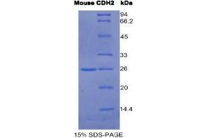 SDS-PAGE analysis of Mouse Cadherin, Neuronal Protein. (N-Cadherin Protéine)