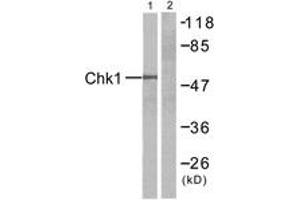 Western blot analysis of extracts from HT-29 cells, treated with UV, using Chk1 (Ab-345) Antibody. (CHEK1 anticorps  (AA 310-359))