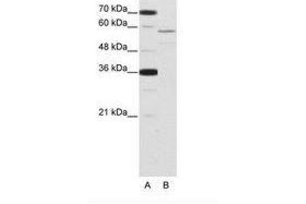 NOVA2 anticorps  (AA 185-234)
