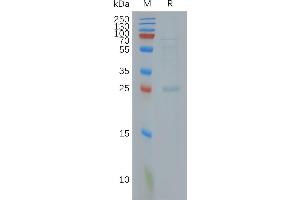 Human C. (CLDN18.2 Protéine)