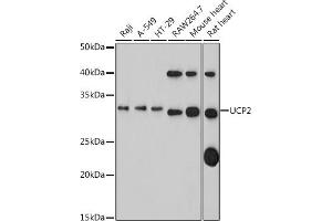 Western blot analysis of extracts of various cell lines, using UCP2 antibody (ABIN1683207, ABIN3018658, ABIN3018659 and ABIN5664678) at 1:1000 dilution. (UCP2 anticorps)