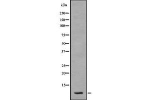 Western blot analysis S100A2 using HT29 whole cell lysates (S100A2 anticorps)