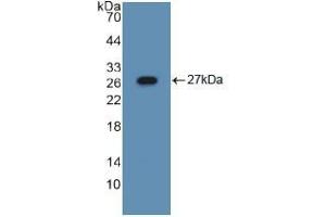 Western blot analysis of recombinant Mouse ASGR1. (Asialoglycoprotein Receptor 1 anticorps  (AA 80-281))