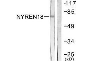 Western blot analysis of extracts from COS7 cells, using NYREN18 antibody. (NUB1 anticorps  (C-Term))