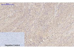 Immunohistochemical analysis of paraffin-embedded human uterus tissue. (IRS1 anticorps)