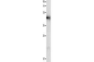 Gel: 12 % SDS-PAGE, Lysate: 40 μg, Lane: Human liver cancer tissue, Primary antibody: ABIN7191316(LRP1 Antibody) at dilution 1/1250, Secondary antibody: Goat anti rabbit IgG at 1/8000 dilution, Exposure time: 40 seconds (LRP1 anticorps)