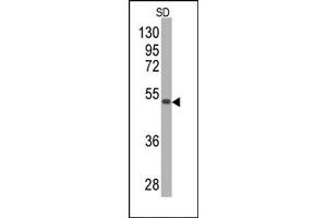 Western Blotting (WB) image for anti-Superoxide Dismutase 2, Mitochondrial (SOD2) antibody (ABIN356396) (SOD2 anticorps)