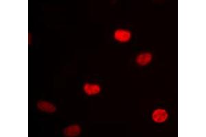Immunofluorescent analysis of hnRNP D0 staining in HEK293 cells. (HNRNPD/AUF1 anticorps  (Center))