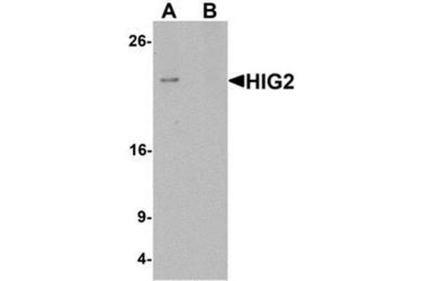 HILPDA anticorps  (C-Term)