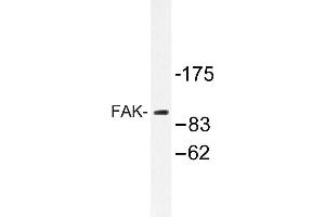 Image no. 1 for anti-PTK2 Protein tyrosine Kinase 2 (PTK2) antibody (ABIN272100) (FAK anticorps)