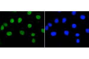A549 cells were stained with Rb(S807) (2D10) Monoclonal Antibody  at [1:200] incubated for overnight at 4C, followed by secondary antibody incubation and DAPI staining. (Retinoblastoma 1 anticorps  (pSer807))