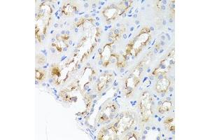 Immunohistochemistry of paraffin-embedded rat kidney using ADIPOQ Antibody (ABIN5971370) at dilution of 1/100 (40x lens). (ADIPOQ anticorps)