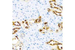 Immunohistochemistry of paraffin-embedded rat kidney using KLK11 antibody. (Kallikrein 11 anticorps)