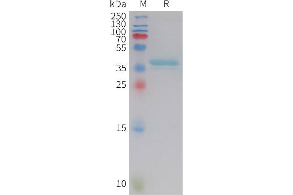 Leptin Protein (LEP) (AA 22-167) (Fc Tag)
