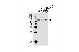 Lane 1: A431 Cell lysates, Lane 2: HepG2 Cell lysates, Lane 3: SH-SY5Y Cell lysates, probed with EIF2AK2 (1441CT628. (EIF2AK2 anticorps)