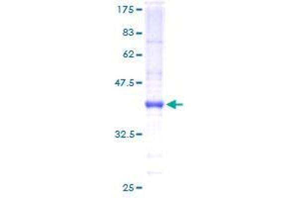 BARX1 Protein (AA 1-100) (GST tag)