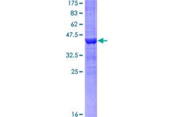 KDM5A Protein (AA 191-290) (GST tag)